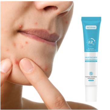 Gel Anti-Acnee cu Acid Salicilic – Curățare Profundă și Reducerea Imperfecțiunilor