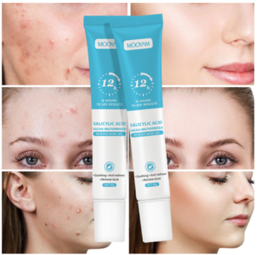 Gel Anti-Acnee cu Acid Salicilic – Curățare Profundă și Reducerea Imperfecțiunilor